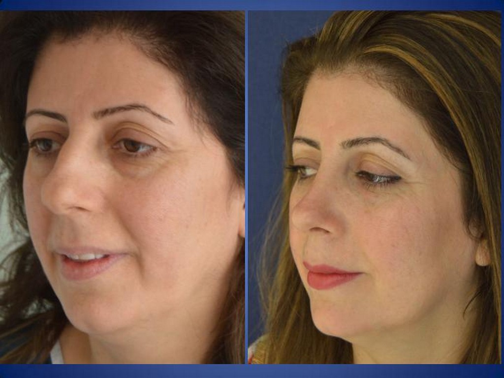 Plastische Chirurgie