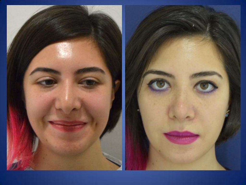 ÄSthetische Chirurgie =
