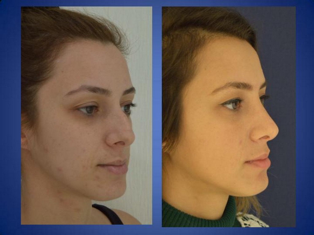 ÄSthetische Chirurgie