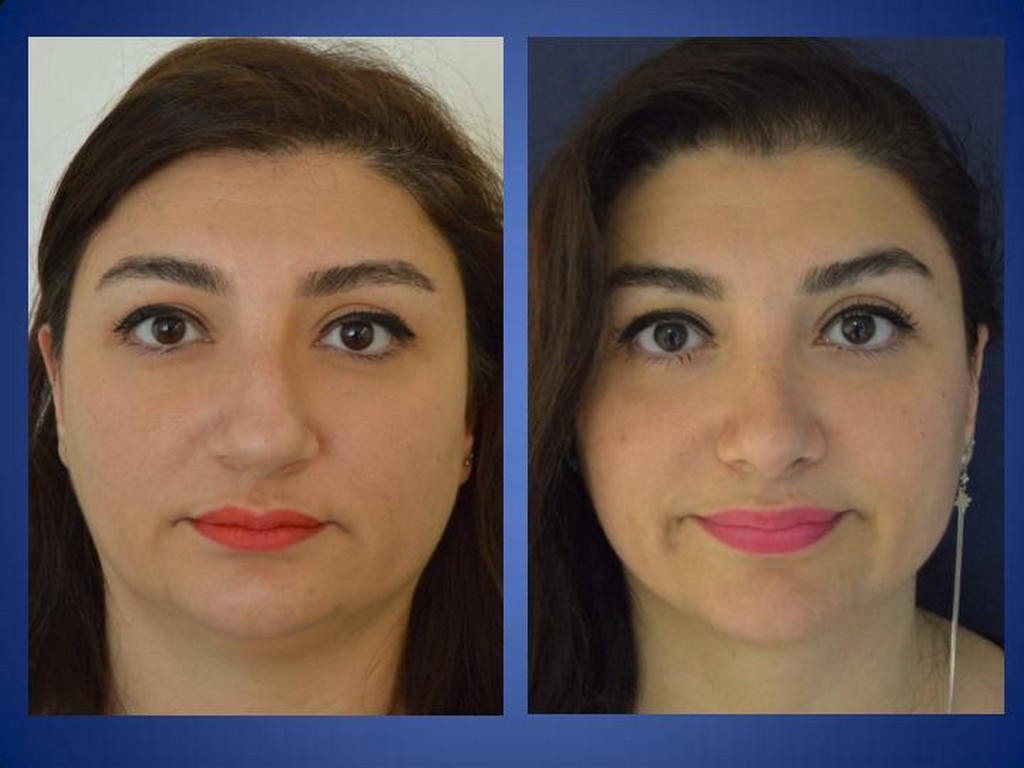 Plastische Chirurgie