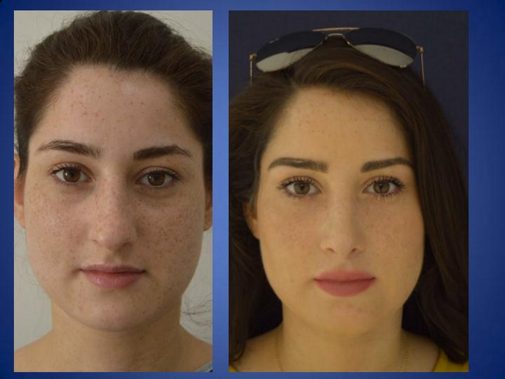 ÄSthetische Chirurgie