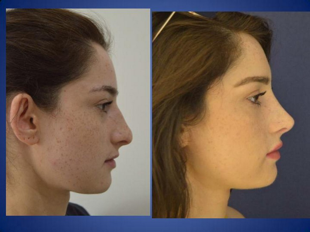 Plastische Chirurgie
