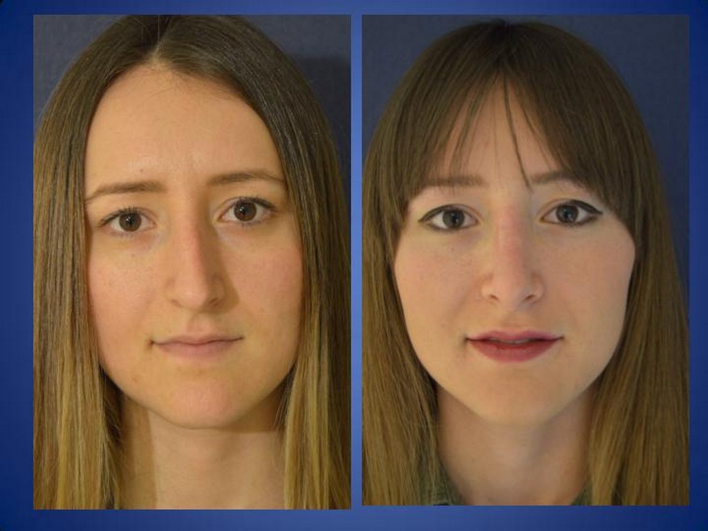 ÄSthetische Chirurgie