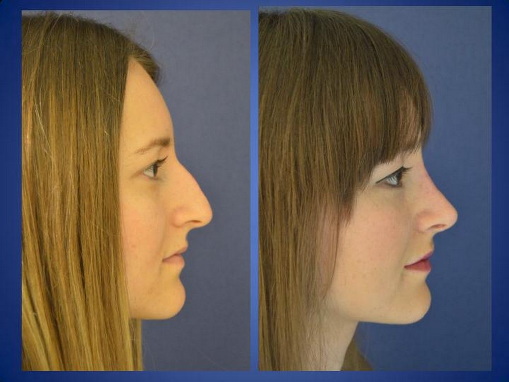 Plastische Chirurgie