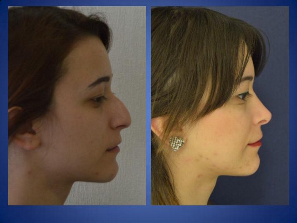 ÄSthetische Behandlungen