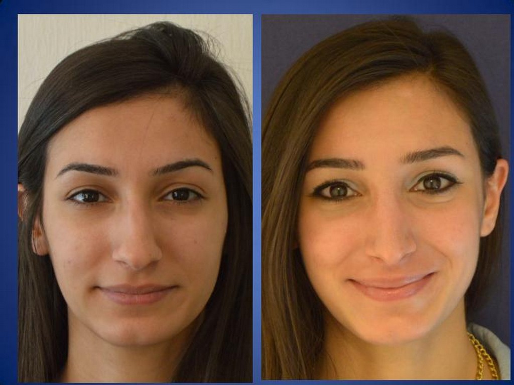 ÄSthetische Chirurgie