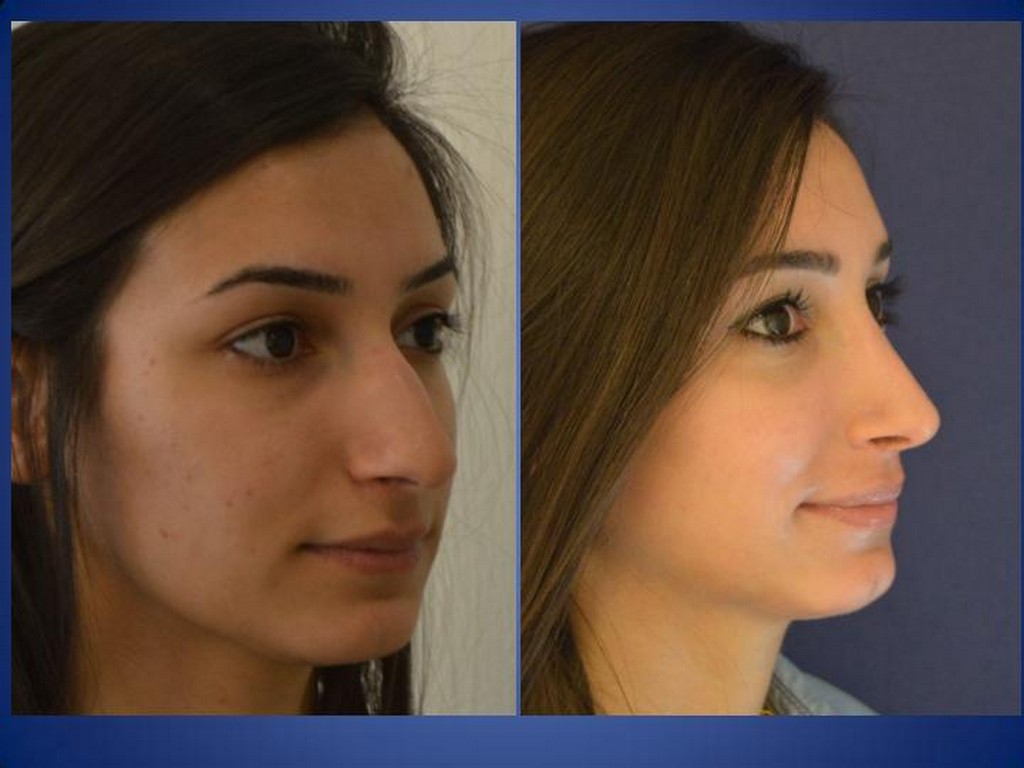 Plastische Chirurgie
