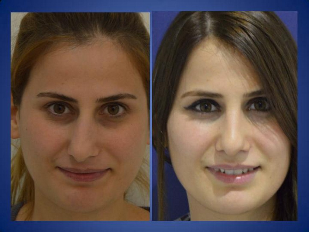 ÄSthetische Chirurgie