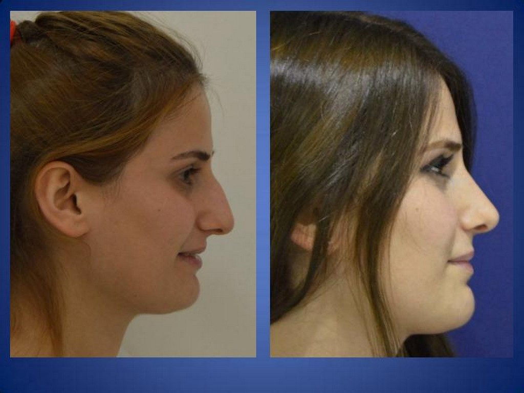 Plastische Chirurgie