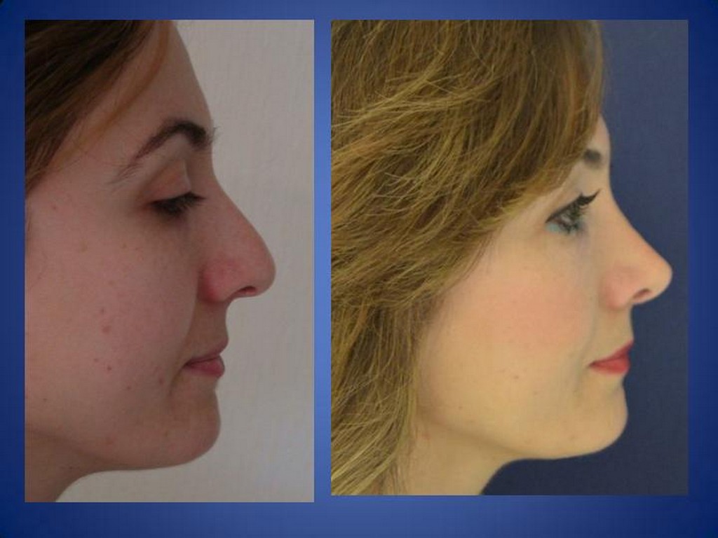 Plastische Chirurgie