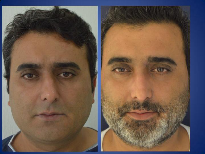 ÄSthetische Chirurgie