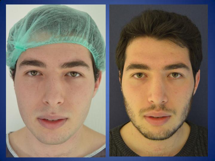 ÄSthetische Behandlungen