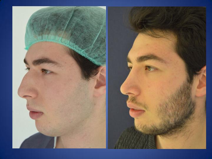 ÄSthetische Chirurgie