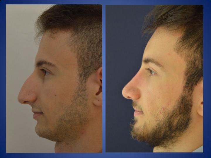 ÄSthetische Behandlungen