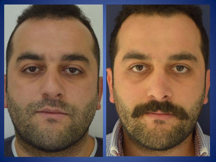 ÄSthetische Chirurgie