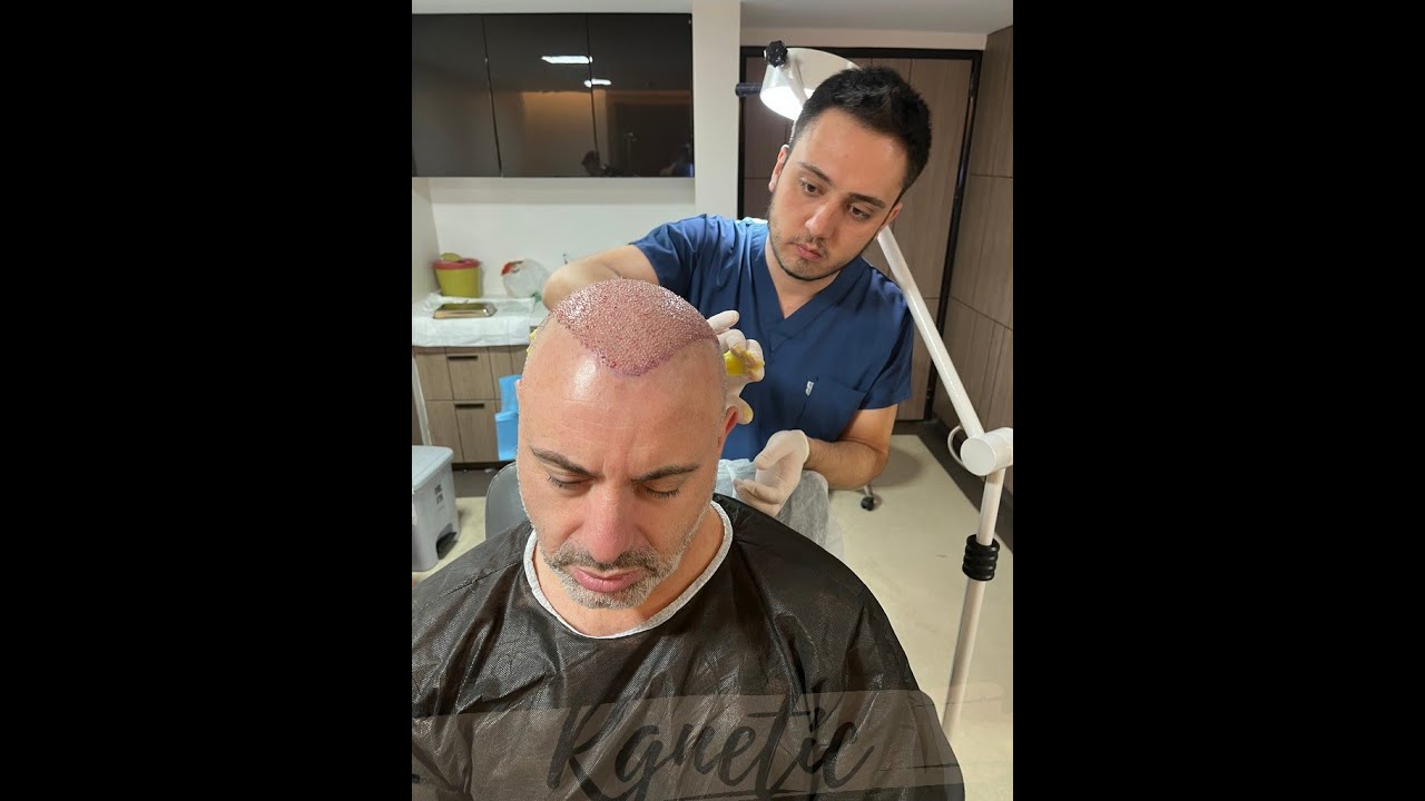 Haartransplantation Patienten Bewertung Herr Litvan