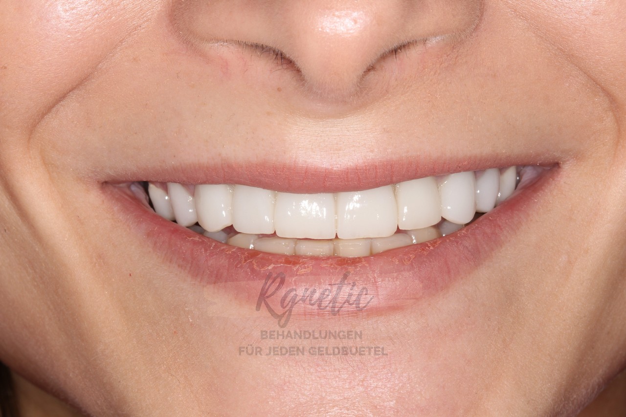 Holly Wood Smile