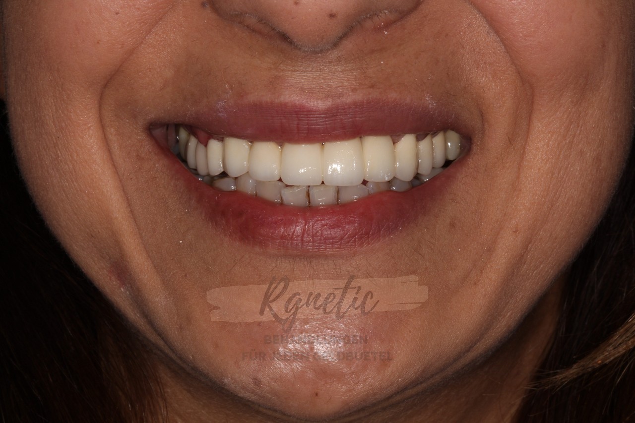 Teeth